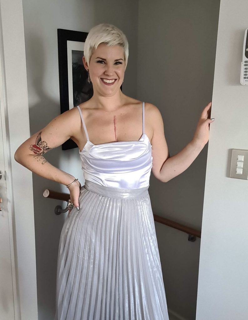 New Zealand resident Hetty poses in a white formal dress showing her scar from her aortic dissection surgery.