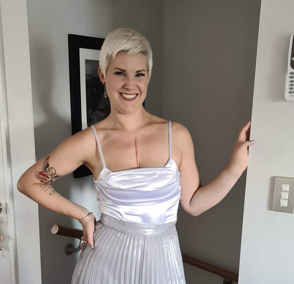 New Zealand resident Hetty poses in a white formal dress showing her scar from her aortic dissection surgery.
